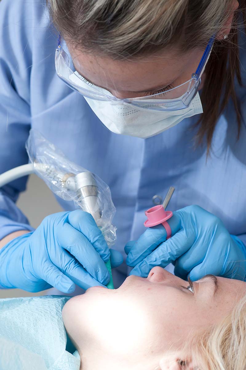 Dental student working on teeth
